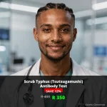 Scrub Typhus Antibody Test ZAR 350 | Same-Day Results | Nationwide SA